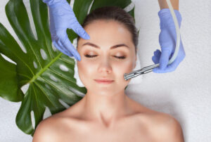 Microdermabrasion / Microneedling in Essen