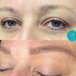 Microblading in Essen