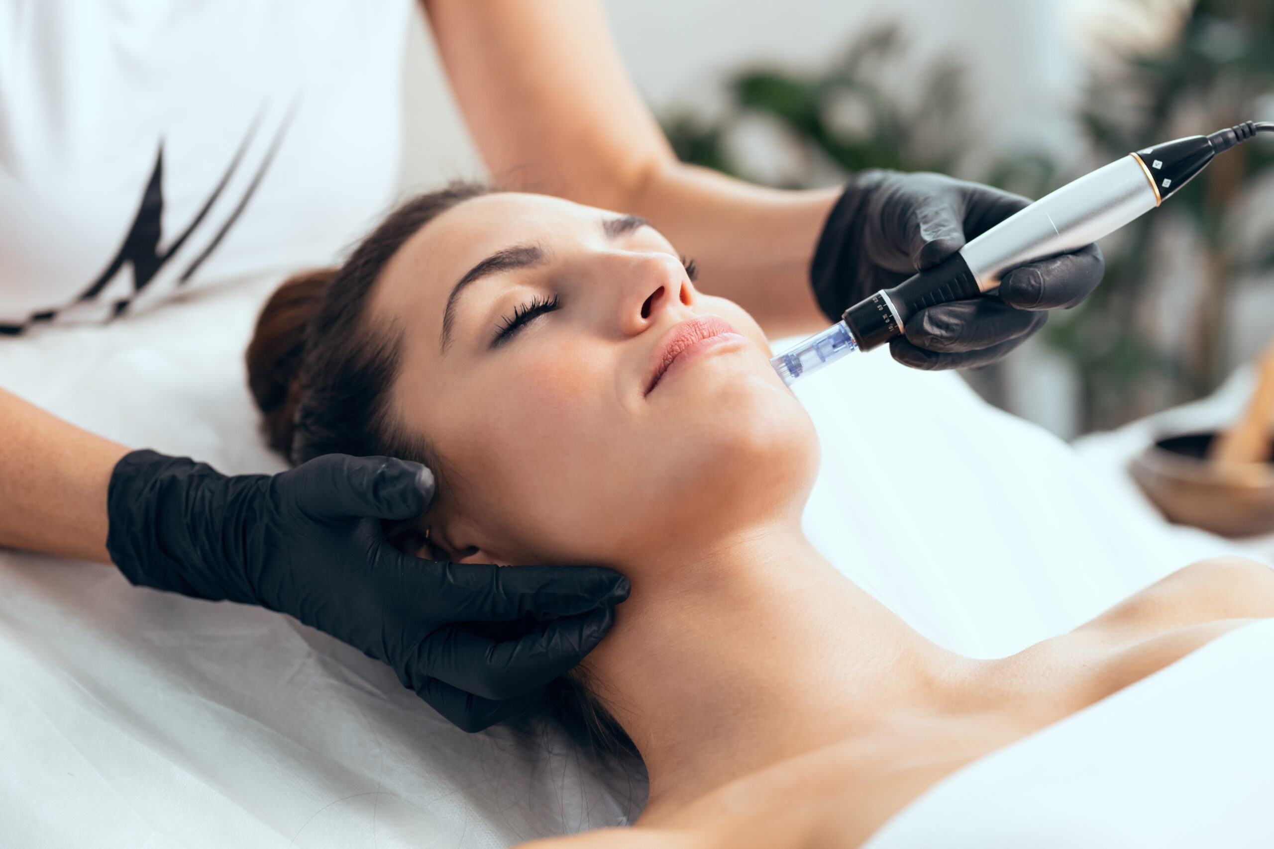 Schulung für Microneedling in Essen