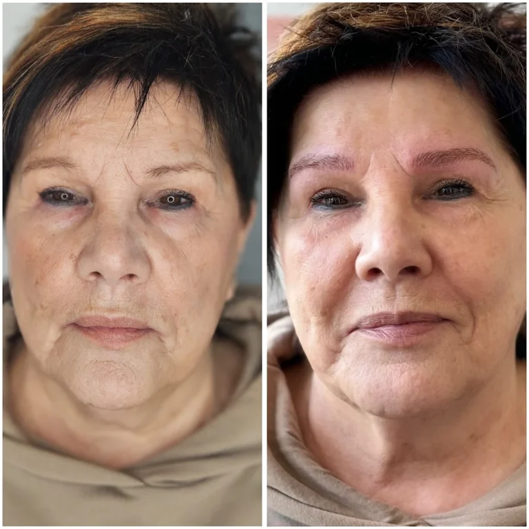 Vorher-Nachher Microblading Behandlung bei MT Cosmetic in Essen – natürliche, perfekt geformte Augenbrauen